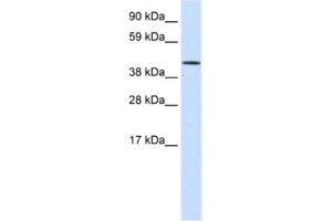 Image no. 1 for anti-SWI/SNF Related, Matrix Associated, Actin Dependent Regulator of Chromatin, Subfamily A, Member 1 (SMARCA1) antibody (ABIN2461529)