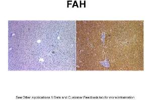 Image no. 4 for anti-Fumarylacetoacetate Hydrolase (Fumarylacetoacetase) (FAH) (C-Term) antibody (ABIN2776935)