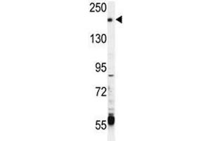 Image no. 2 for anti-Transient Receptor Potential Cation Channel, Subfamily M, Member 6 (TRPM6) (AA 317-348) antibody (ABIN3029237)