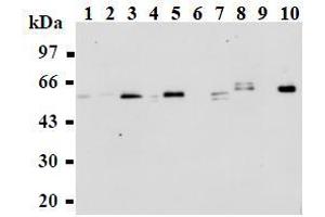 Image no. 1 for anti-Abl-Interactor 1 (ABI1) antibody (ABIN1449186)