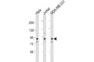 Image no. 2 for anti-Myb-Like, SWIRM and MPN Domains 1 (MYSM1) (AA 111-139), (N-Term) antibody (ABIN654474)