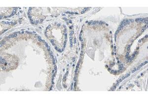 Image no. 1 for anti-Calreticulin (CALR) (N-Term) antibody (ABIN6256980)