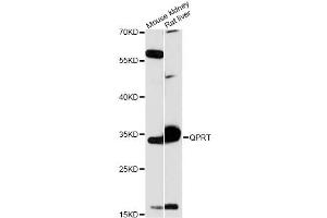 Image no. 1 for anti-Quinolinate Phosphoribosyltransferase (QPRT) antibody (ABIN6290813)