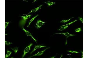 Image no. 2 for anti-Mitochondrial Ribosomal Protein L12 (MRPL12) (AA 1-198) antibody (ABIN948420)