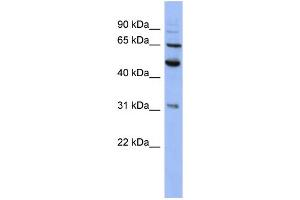 Image no. 1 for anti-Proteasome (Prosome, Macropain) 26S Subunit, Non-ATPase, 3 (PSMD3) (N-Term) antibody (ABIN2786726)