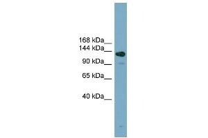 Image no. 1 for anti-Additional Sex Combs Like 2 (ASXL2) (Middle Region) antibody (ABIN2787104)