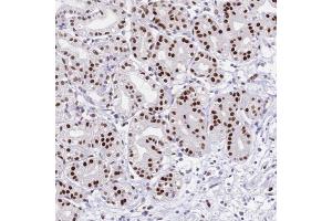 Image no. 1 for anti-Nuclear Factor I/C (CCAAT-Binding Transcription Factor) (NFIC) antibody (ABIN5584435)