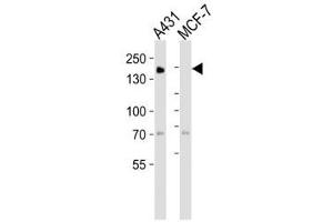 Image no. 1 for anti-Epidermal Growth Factor Receptor (EGFR) (AA 1163-1191) antibody (ABIN3030852)