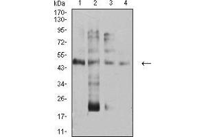 anti-Transcription Factor AP-2 alpha (Activating Enhancer Binding Protein 2 Alpha) (TFAP2A) (AA 105-211) antibody