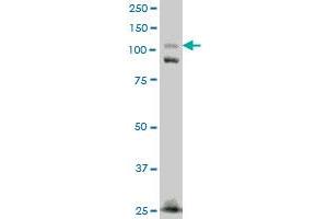 Image no. 2 for anti-Fibronectin Type III Domain Containing 3A (FNDC3A) (AA 1012-1110) antibody (ABIN524813)