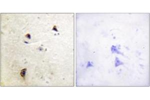 anti-Rabphilin 3A (RPH3A) (AA 203-252), (pSer237) antibody