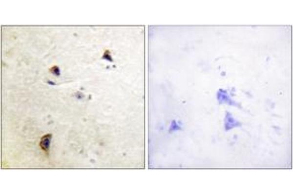 anti-Rabphilin 3A (RPH3A) (AA 203-252), (pSer237) antibody