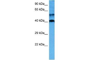 Image no. 4 for anti-SRY (Sex Determining Region Y)-Box 18 (SOX18) (Middle Region) antibody (ABIN2777725)
