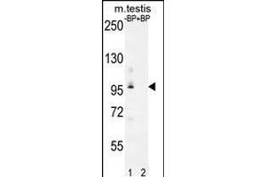 Image no. 1 for anti-Pyruvate Dehydrogenase Phosphatase (PDP) (AA 821-850), (C-Term) antibody (ABIN5537820)