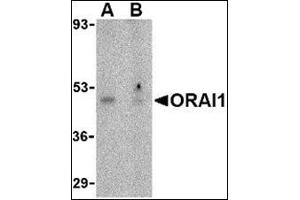 Image no. 2 for anti-ORAI Calcium Release-Activated Calcium Modulator 1 (ORAI1) (N-Term) antibody (ABIN500419)