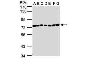 Image no. 2 for anti-UV Stimulated Scaffold Protein A (UVSSA) (N-Term) antibody (ABIN2854576)