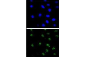 Confocal immunofluorescent analysis of PTEN antibody with 293 cells followed by Alexa Fluor 488-conjugated goat anti-rabbit lgG (green).