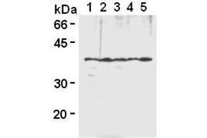 Image no. 1 for anti-Heterogeneous Nuclear Ribonucleoprotein A2/B1 (HNRNPA2B1) antibody (ABIN1449240)