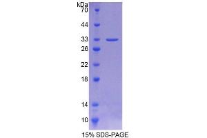 Image no. 1 for Aurora Kinase C (AURKC) (AA 92-339) protein (T7 tag,His tag) (ABIN6238701)