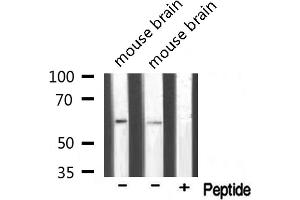 Image no. 3 for anti-TRAF3 Interacting Protein 3 (TRAF3IP3) (Internal Region) antibody (ABIN6257536)