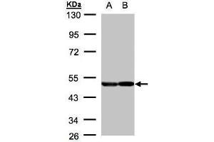 Image no. 1 for anti-Enolase 2 (Gamma, Neuronal) (ENO2) (Center) antibody (ABIN2855087)