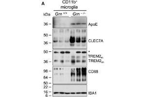 Image no. 16 for anti-Allograft Inflammatory Factor 1 (AIF1) (C-Term) antibody (ABIN2857032)