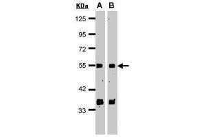 WB Image Sample(30 μg of whole cell lysate) A:HeLa S3 , B:MOLT4 , 15% SDS PAGE antibody diluted at 1:1000