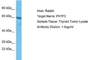 Image no. 1 for anti-Putative Homeodomain Transcription Factor 2 (PHTF2) (C-Term) antibody (ABIN2783780)