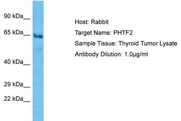 anti-Putative Homeodomain Transcription Factor 2 (PHTF2) (C-Term) antibody