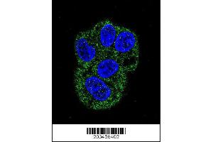 Image no. 4 for anti-Lactotransferrin (LTF) antibody (ABIN658977)