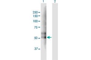 Image no. 1 for anti-Transmembrane Protease, serine 2 (TMPRSS2) (AA 1-492) antibody (ABIN521005)