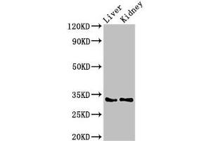 Western Blot Positive WB detected in: Rat liver tissue, Mouse kidney tissue All lanes: HEXIM2 antibody at 3 μg/mL Secondary Goat polyclonal to rabbit IgG at 1/50000 dilution Predicted band size: 33 kDa Observed band size: 33 kDa
