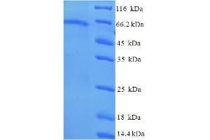 Image no. 1 for Tubulin, beta 6 (TUBb6) (AA 1-446), (full length) protein (His-SUMO Tag) (ABIN5711879)