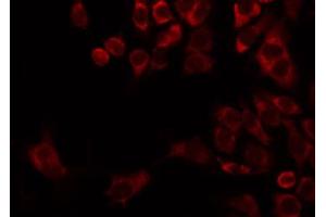 Image no. 1 for anti-Mitochondrial Ribosomal Protein L22 (MRPL22) (Internal Region) antibody (ABIN6258517)