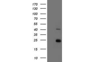 Image no. 3 for anti-Ubiquitin-Conjugating Enzyme E2E 3 (UBE2E3) antibody (ABIN1501617)