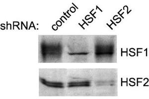 Image no. 2 for anti-Heat shock factor protein 2 (HSF2) antibody (Alkaline Phosphatase (AP)) (ABIN2484642)