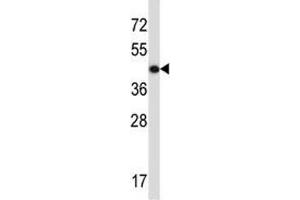 Image no. 2 for anti-Actin, gamma 2, Smooth Muscle, Enteric (ACTG2) (AA 343-371) antibody (ABIN3029839)