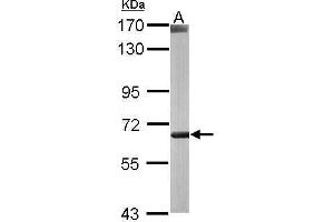 Image no. 3 for anti-Carnitine O-Octanoyltransferase (CROT) (Internal Region) antibody (ABIN2856069)