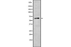 Image no. 1 for anti-SUMO/sentrin Specific Peptidase 3 (SENP3) (Internal Region) antibody (ABIN6264985)