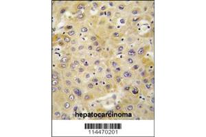 Immunohistochemistry (IHC) image for anti-Pro-Platelet Basic Protein (Chemokine (C-X-C Motif) Ligand 7) (PPBP) (C-Term) antibody (ABIN2494994)