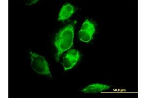 Image no. 2 for anti-Mitochondrial Ribosomal Protein L1 (MRPL1) (AA 1-303) antibody (ABIN528765)
