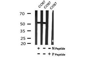 Image no. 3 for anti-Microphthalmia-Associated Transcription Factor (MITF) (pSer516) antibody (ABIN6269699)
