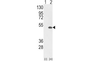 Western Blotting (WB) image for anti-Ets Variant 4 (ETV4) antibody (ABIN3002727)