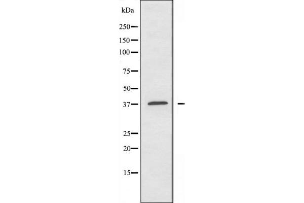A4GNT Antikörper  (C-Term)