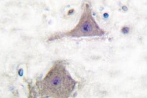 Image no. 2 for anti-Glutamate Receptor, Metabotropic 7 (GRM7) antibody (ABIN265440)