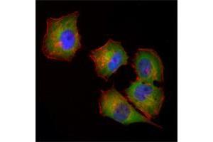 Image no. 2 for anti-Non-Metastatic Cells 1, Protein (NM23A) Expressed in (NME1) antibody (ABIN969317)