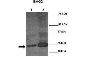 Image no. 1 for anti-Aryl Hydrocarbon Receptor Nuclear Translocator (ARNT) (C-Term) antibody (ABIN2777195)