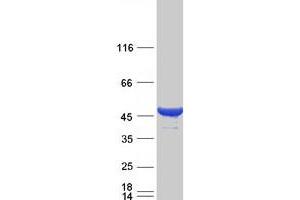 Image no. 1 for Cytohesin 2 (CYTH2) (Transcript Variant 1) protein (Myc-DYKDDDDK Tag) (ABIN2712816)