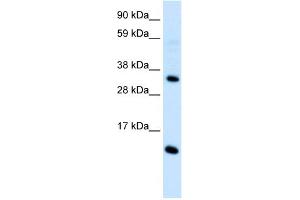 Image no. 2 for anti-Chemokine (C-C Motif) Ligand 18 (Pulmonary and Activation-Regulated) (CCL18) (Middle Region) antibody (ABIN2792202)