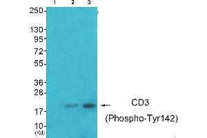 Image no. 2 for anti-CD247 Molecule (CD247) (pTyr142) antibody (ABIN1847268)